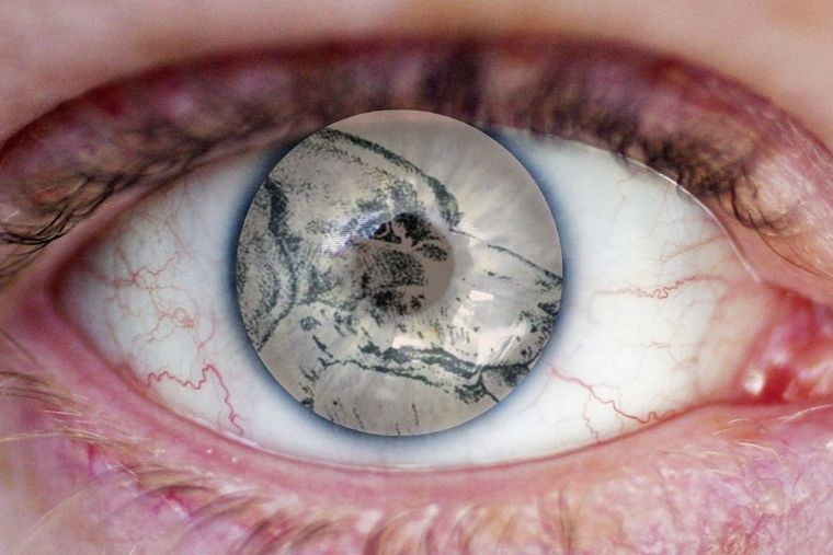 Test visual Test visual - pon a prueba tu agudeza visual Foto: tuul.tv