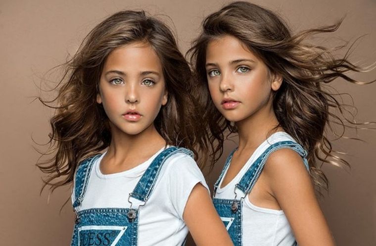 Las gemelas son consideradas las más lindas del mundo.