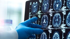 Los traumatismos en la cabeza pueden generar alteraciones cerebrales.