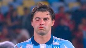 El terrible golpe accidental de su compañero Marcos Rojo le provocó una fractura a Santiago Sosa en el final del partido de ida en Brasil.  El terrible golpe accidental de su compañero Marcos Rojo le provocó una fractura a Santiago Sosa en el final del partido de ida en Brasil.