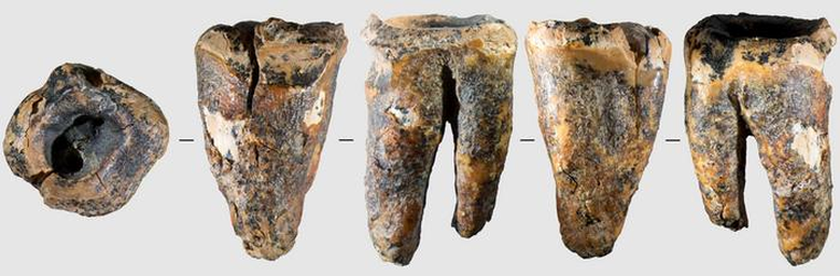 Los científicos estudian de cerca este diente de 59.000 años. Los científicos estudian de cerca este diente de 59.000 años. 