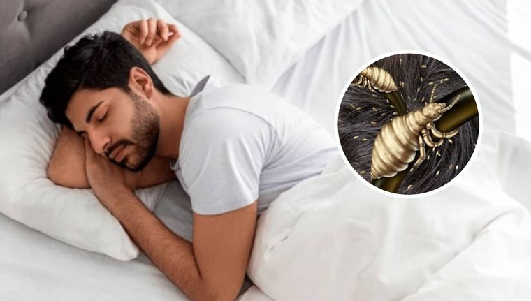 Cuál es el significado de soñar con piojos (Shutterstock).