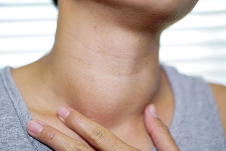 Mantener un control estricto de los niveles hormonales de tiroides.