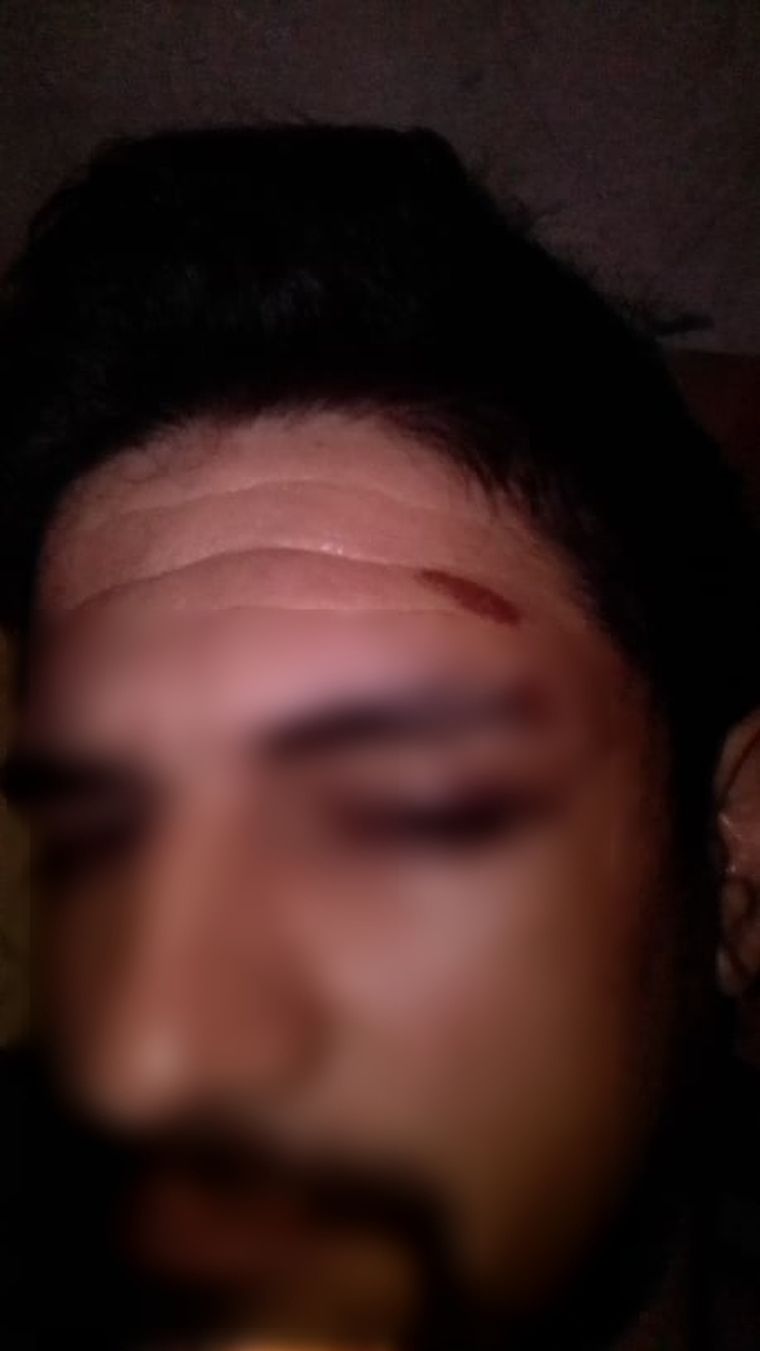 Golpeado Fernando dice que le duele hasta el pelo. Se despertó y no recuerda nada.