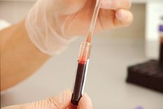 Un estudio sobre el sistema inmunológico de las personas con depresión abre el camino para diagnosticar la enfermedad a través de la sangre. Foto: Conicet