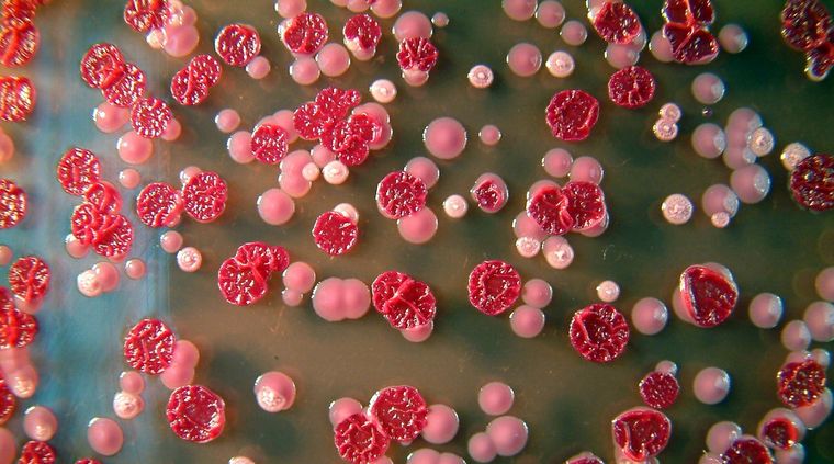 Melioidosis. Foto: joya.life