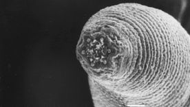 Esta imagen microscópica muestra la punta del llamado "gusano del diablo".