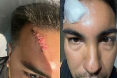 Las heridas de Maximiliano Lucero. Foto: X Las heridas de Maximiliano Lucero. Foto: X