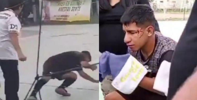 El árbitro herido. Foto: NA