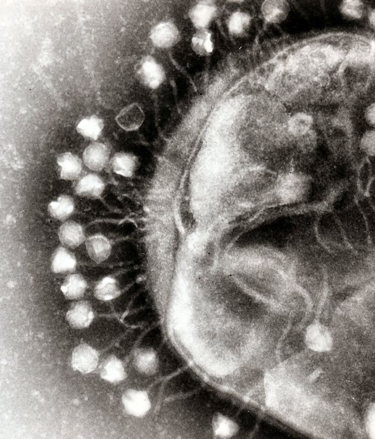 Imagen ilustrativa del virus Foto: Professor Graham Beards