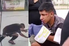 El árbitro herido. Foto: NA