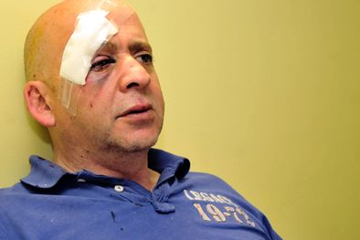 MDZol | Imagen de Guerra tras la paliza. Foto: Mediamza.com