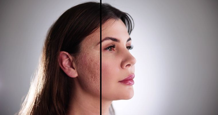 El retoque facial de Google Photos ampliará las opciones de edición más allá de los dispositivos Pixel. El retoque facial de Google Photos ampliará las opciones de edición más allá de los dispositivos Pixel.