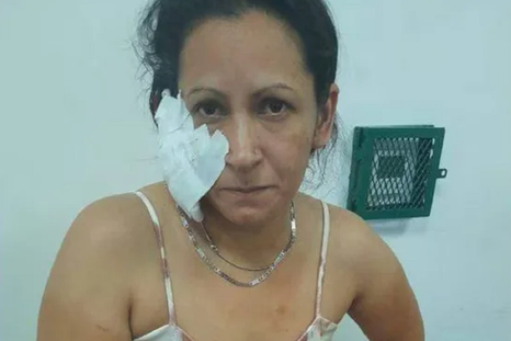 Mujer agredida por su pareja Foto: NA