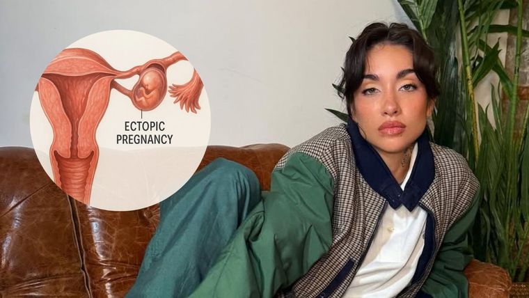 Foto: Ilustración MDZ