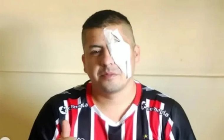 Jonathan Navarro con un parche en el ojo tras la represión policial en el Congreso Foto: NA