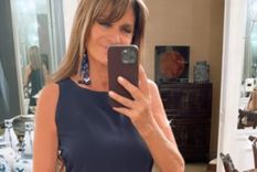 Teresa Calandra compartió un fuerte mensaje sobre las cirugías estéticas La ex modelo y actriz dejó una reflexión en las redes sociales Foto: @teresacalandra