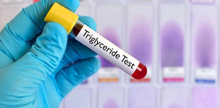 Es importante mantener los niveles recomendados de triglicéridos en la sangre Foto: Shutterstock