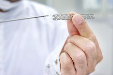 Entre los insumos que escasean para las prácticas médicas por cateterismo, se encuentran los stents, que son los dispositivos que se utilizan en la angioplastia Foto: Shutterstock