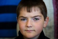 Algunos niños, como Dennis (en la imagen), llegaron al complejo de Tarará en Cuba para recibir tratamiento para sus dolencias médicas tras la catástrofe de Chernobyl.