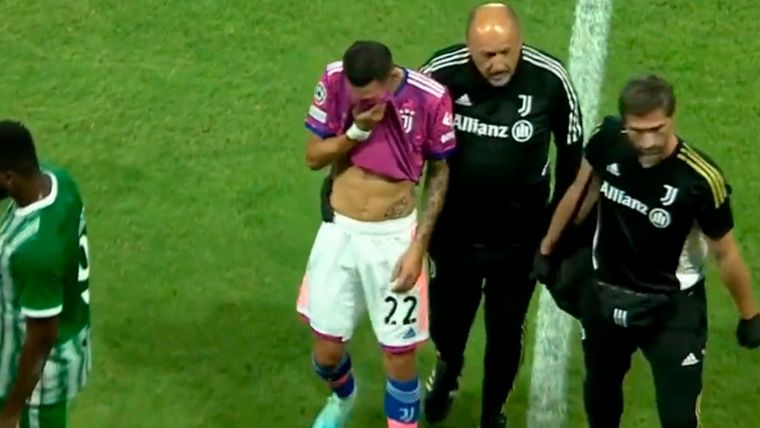 Ángel Di María El Fideo se lesionó en el partido de Juventus.