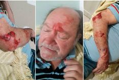 mdz radio: la legitima defensa desde la mirada de un abogado