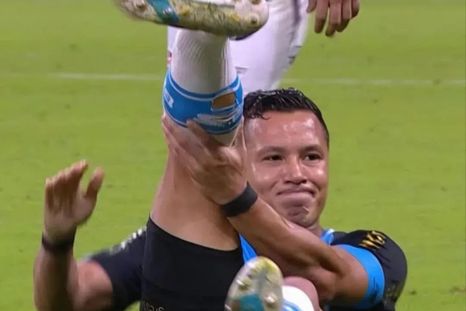 Marlon, defensor del Gremio de Porto Alegre, sufrió una escalofriante lesión en su tobillo. Marlon, defensor del Gremio de Porto Alegre, sufrió una escalofriante lesión en su tobillo.