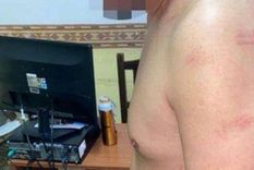 una mujer le dio una paliza a su pareja por una supuesta infidelidad