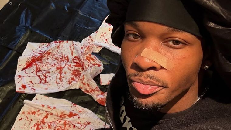 El joven artista que podría estar involucrado en un macabro caso. Créditos: Instagram / d4vddd