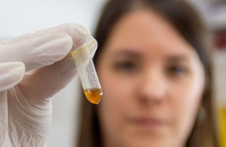 Las numerosas investigaciones sobre VPH señalan al genotipo de alto riesgo como la causa para el desarrollo del cáncer de cuello de útero Foto: Unciencia