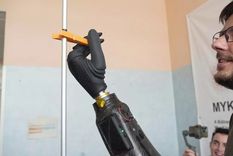 Daniel, de 34 años, agarrando una pinza con prótesis biónica. Foto: 2024 Scuola Superiore Sant’Anna