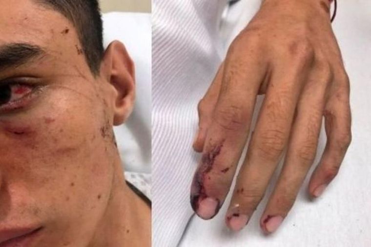 Milo Milo debió ser internado a causa de la paliza.