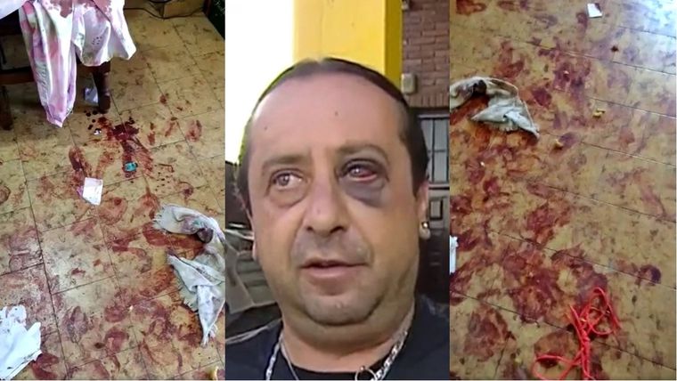 Claudio, el mecánico torturado por delincuentes que le tomaron el champán que tenía en la heladera