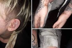 El joven mostró las heridas que le causaron los policías denunciados