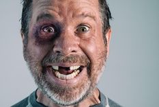 De no creer: ¿Qué significa soñar que se me caen los dientes? Los sueños son experiencias mentales y emocionales que ocurren durante el sueño. Estos pueden ser confusos y abstractos o vívidos y realistas. Foto: Archivo