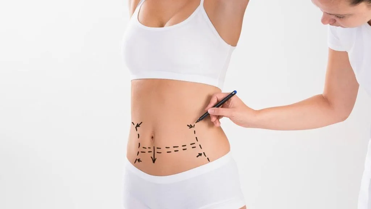 A nivel global, procedimientos como la liposucción y la abdominoplastia se encuentran entre las cirugías estéticas más populares para mujeres.
