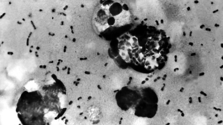 La bacteria Yersinia pestis causa la pesta bubónica Foto: GETTY IMAGES
