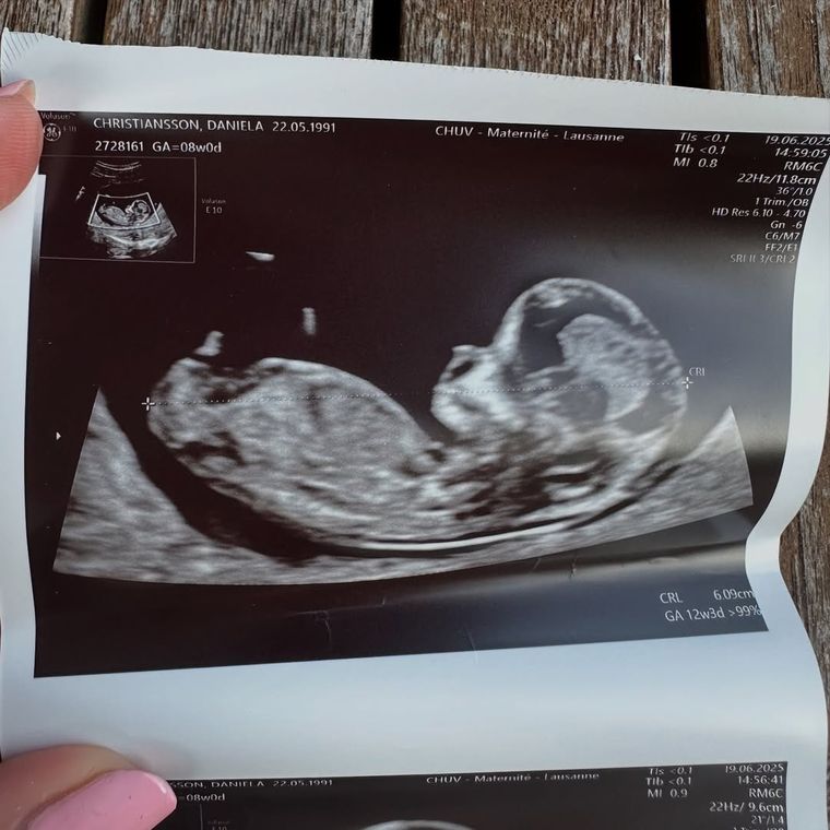 La ecografía que compartió Daniela en su cuenta de Instagram. Foto: Instagram/ @danielachristiansson. La ecografía que compartió Daniela en su cuenta de Instagram. Foto: Instagram/ @danielachristiansson. 