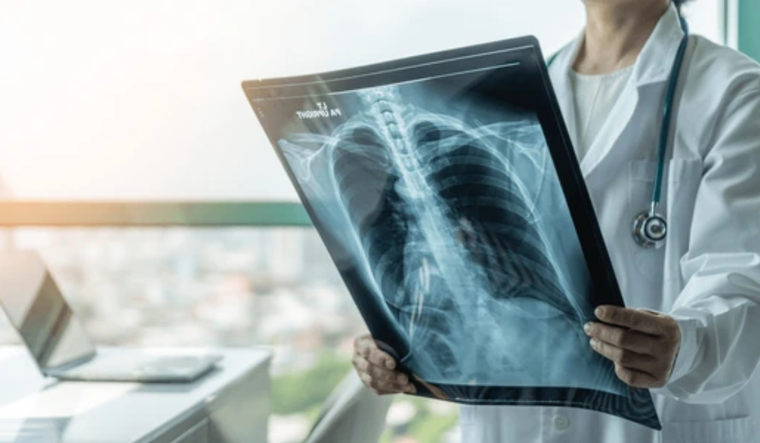 Qué es la hipoxemia, cuáles son sus causas y cuándo ir al médico. Foto: Shutterstock