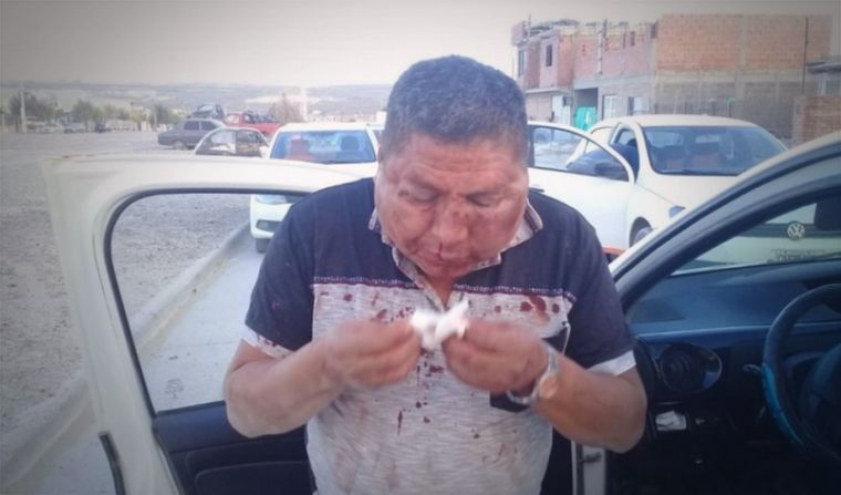 Así quedó El taxista sufrió una tremenda golpiza. Foto: diario TiempoSur