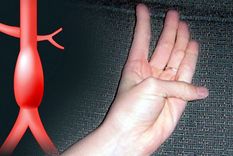 El test. Foto: MedicalXpress.