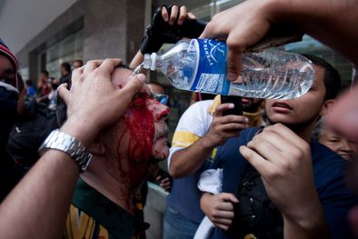 MDZol | Foto: The Associated Press