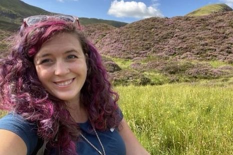 Foto: AILSA BURN-MURDOCH. Ailsa se sometió al mismo tratamiento que la modelo Linda Evangelista.