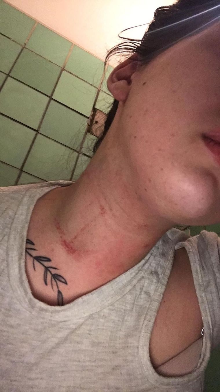 La víctima del hecho compartió una foto de las heridas