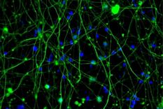 El minicerebro de Phil.