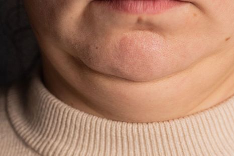 Si tu cuello se ve más grueso o más delgado de lo habitual, puede indicar algunos problemas de salud.