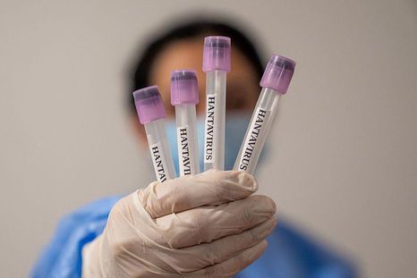 no tiene nada que ver con la covid, el hantavirus tiene escasa capacidad para producir epidemias o una pandemia no tiene nada que ver con la covid, el hantavirus tiene escasa capacidad para producir epidemias o una pandemia