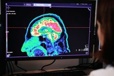 Nuestro cerebro está configurado para sobrevivir a las situaciones extremas, pero su respuesta varía en función de diversos factores.