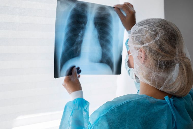 Aumentaron un 38% los casos de tuberculosis en Argentina. Foto: Freepik.
