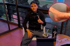 Zeballos tendrá entre cuatro y seis meses de rehabilitación. Zeballos tendrá entre cuatro y seis meses de rehabilitación.